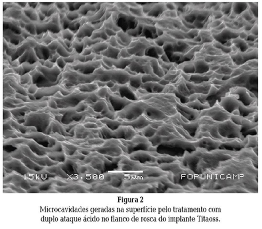 Superfície Implantes Intraoss