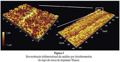 Superfície Implantes Intraoss