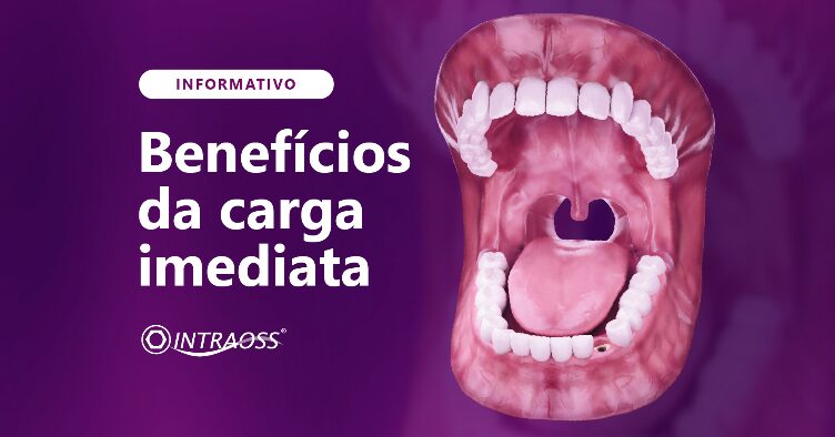 Benefícios da carga imediata